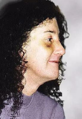 facial
