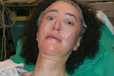 facial