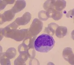 Te sacaron sangre para analisis clinicos, este es tu post!