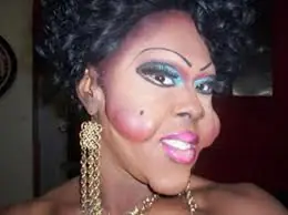 esteticas