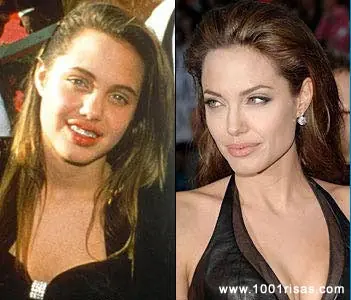 Cirugías estéticas en hombres!