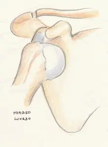 lesiones