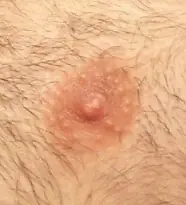 Para que nos sirven los pezones a los hombres?