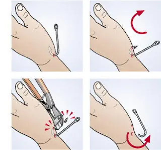 cuidado