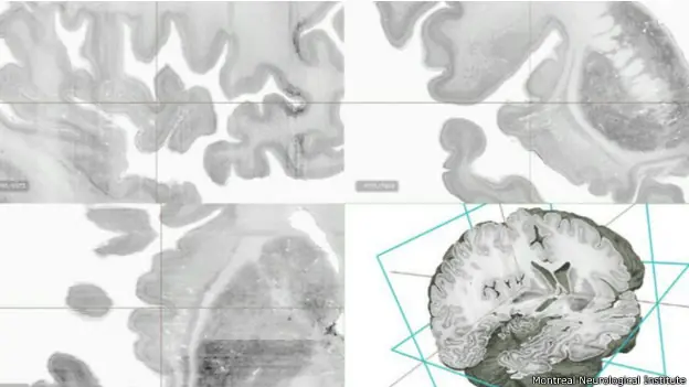 Crean el mapa del cerebro humano en 3D hiper detallado