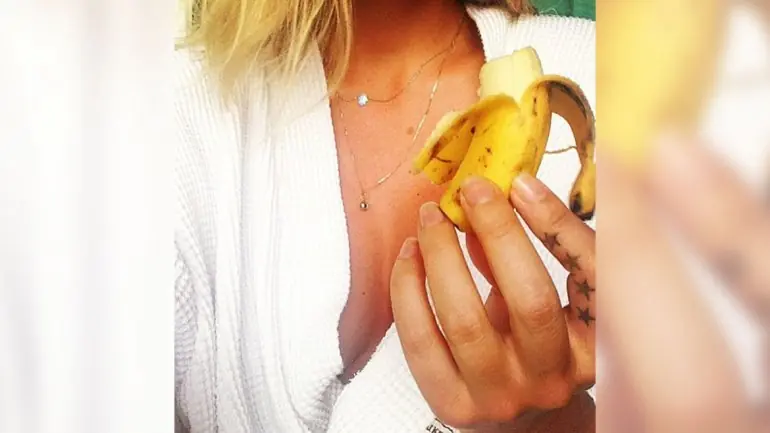 La joven que vive comiendo 20 bananas por día