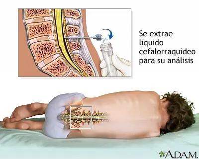 médula espinal