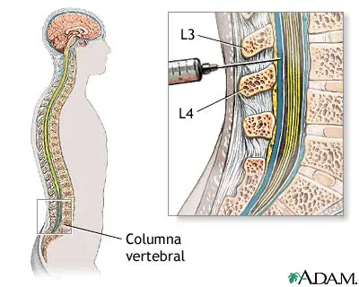 Columna vertebral , médula espinal , LCR