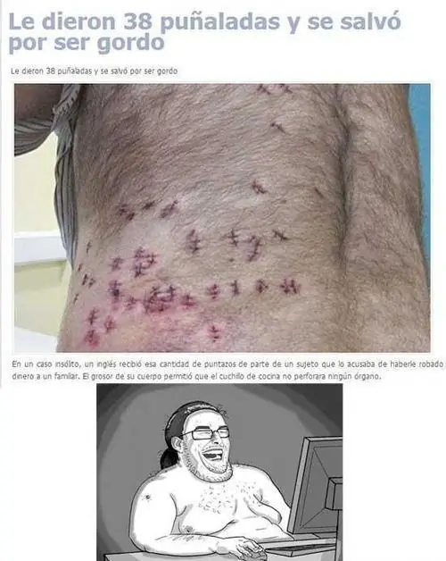 imagenes