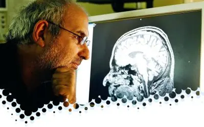 neurologo