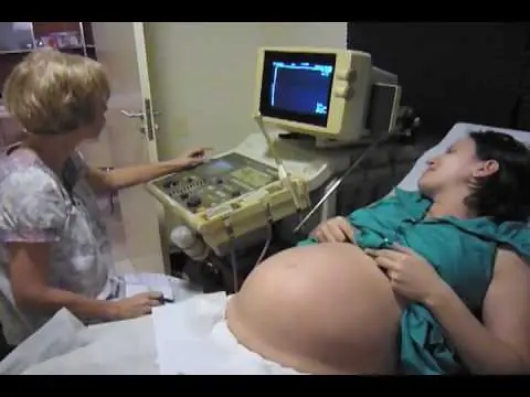 A punto de dar a luz