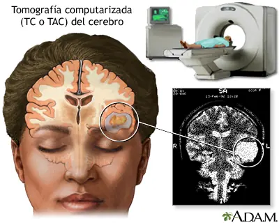 Sufres de Dolor de Cabeza?