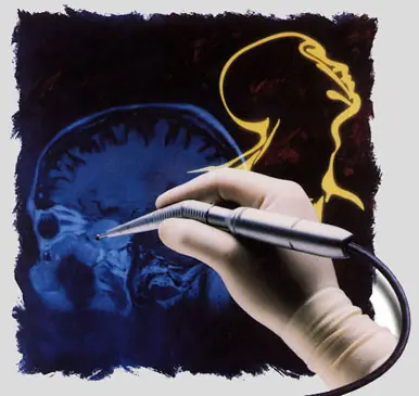 El cerebro [Megapost]