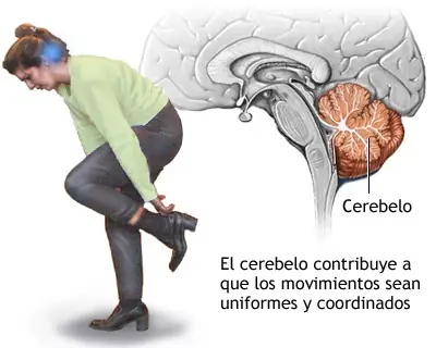 cerebro