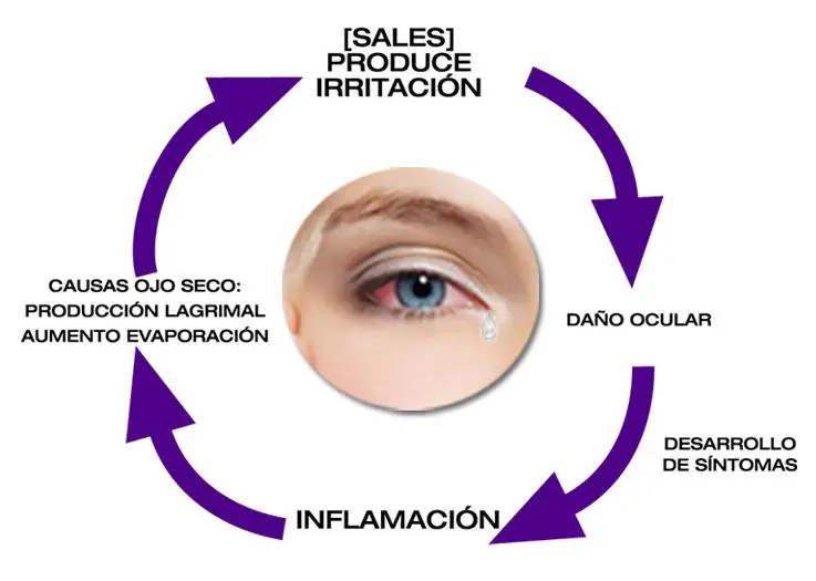 Ojos