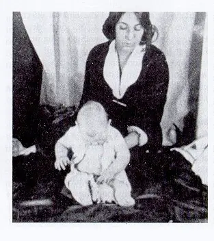 Experimento del "Pequeño Albert" (Watson y Rayner