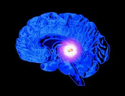 Cómo desintoxicar la glándula pineal