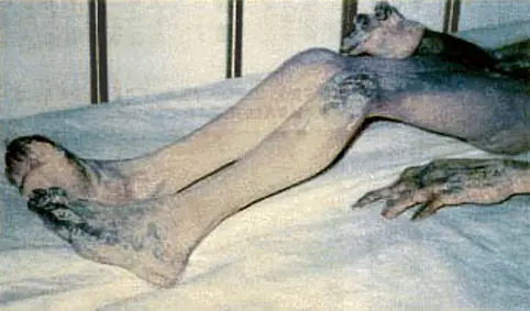 ovini