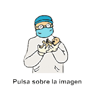 parto