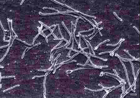 Cultivando Bacterias