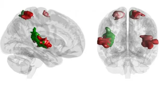 Así se ve tu cerebro oyendo los Beatles