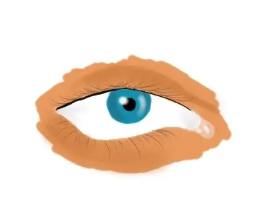mis