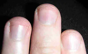 Las uñas.