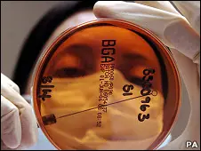 Super bacteria causa preocupación.