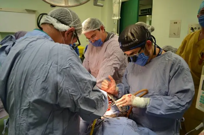 transplante