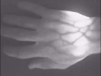 filtro ir
