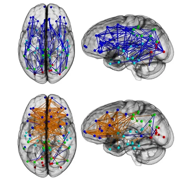 Diferencias en el cerebro entre hombres y mujeres