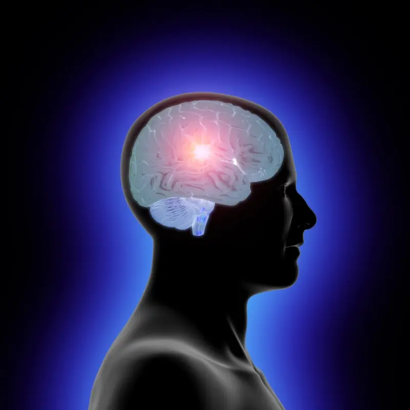 Como saber si te esta por dar un ataque cerebral!