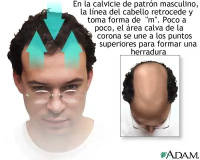 habra