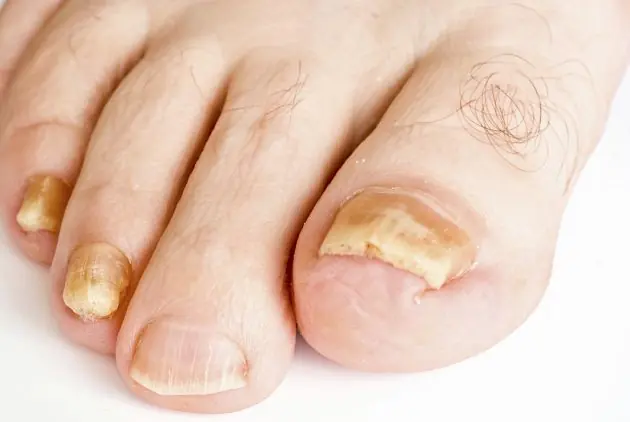 cuticula