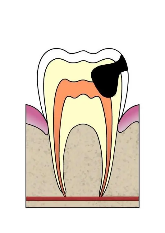 dientes