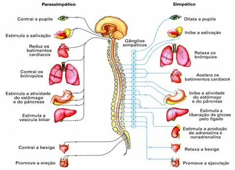 neuropatía