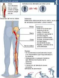 seguro