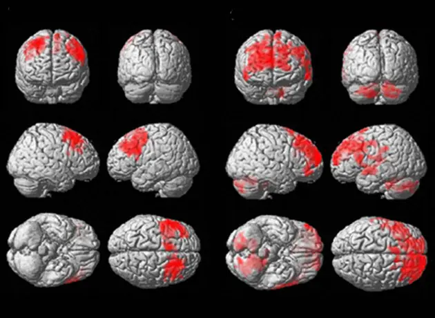 Éste es tu cerebro después de jugar a...