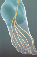 no