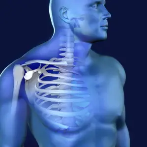 Cuando el cáncer se expande a los huesos