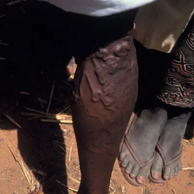 frica