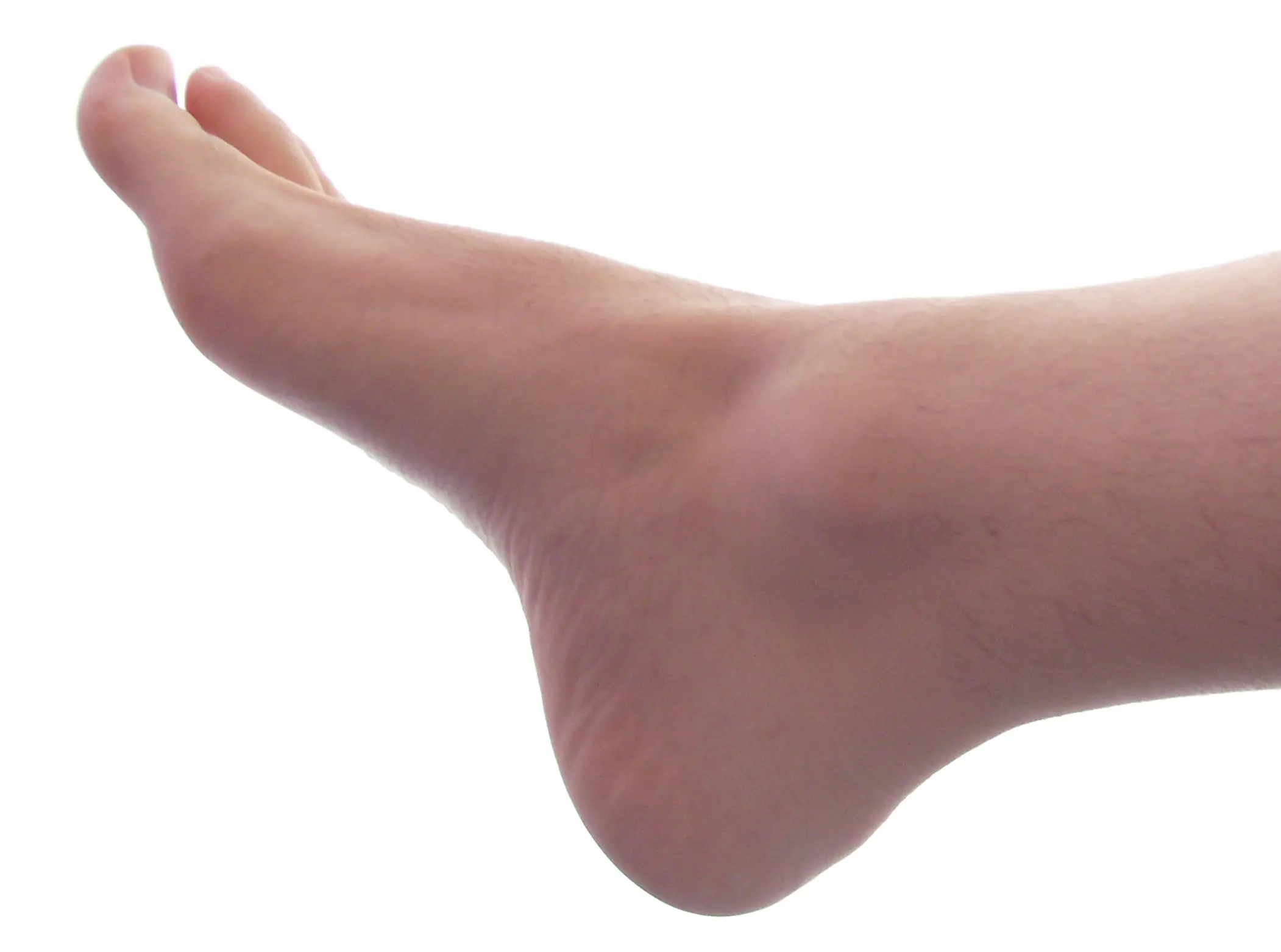 patas