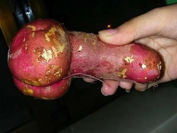fondos