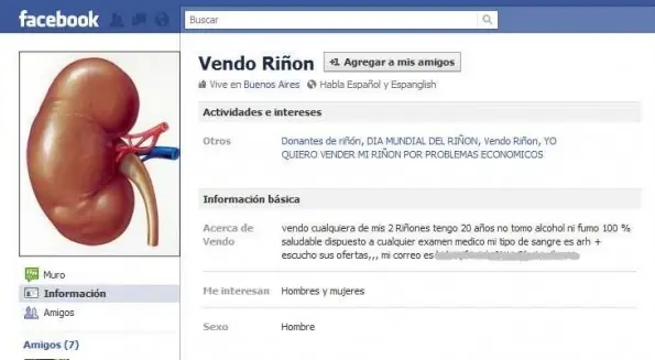 Cuál de mis órganos podría vender sin morir ?