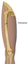 vendaje