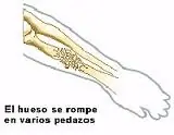 forma