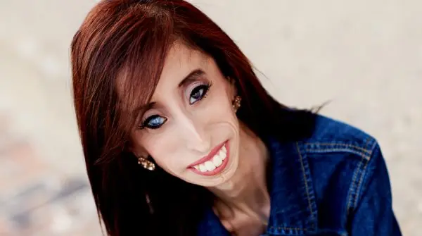La mujer más fea del mundo y un gran mensaje