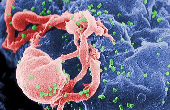 Utilizan con éxito el VIH para curar 2 enfermedades genéti