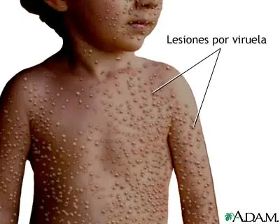 educacion