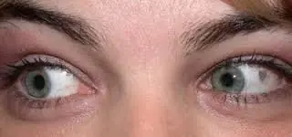 oculares